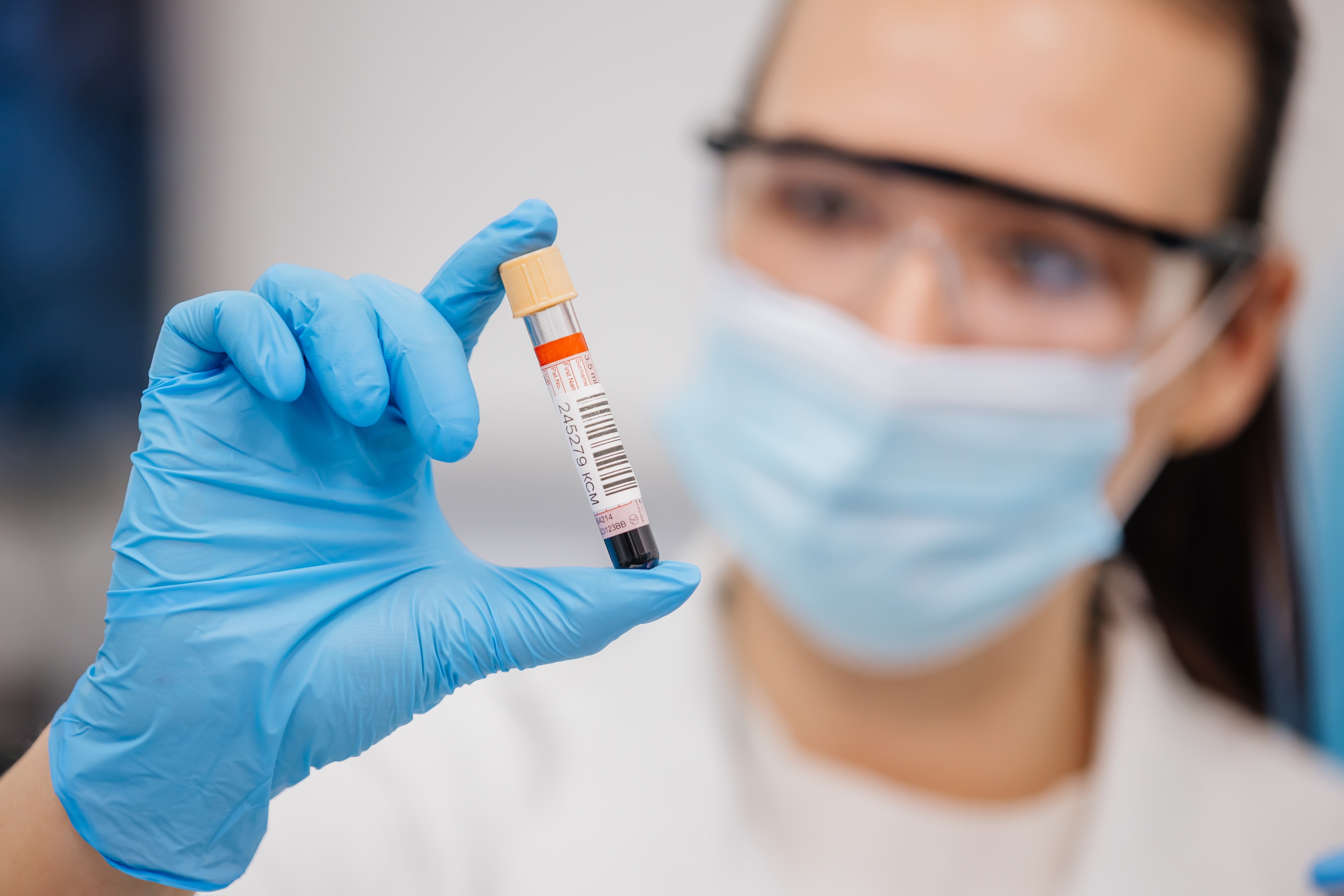 Blood test boosts hopes of early Alzheimer’s diagnosis