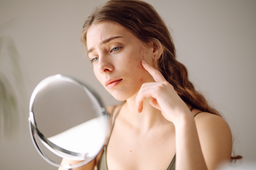 Why do people abandon acne treatments?